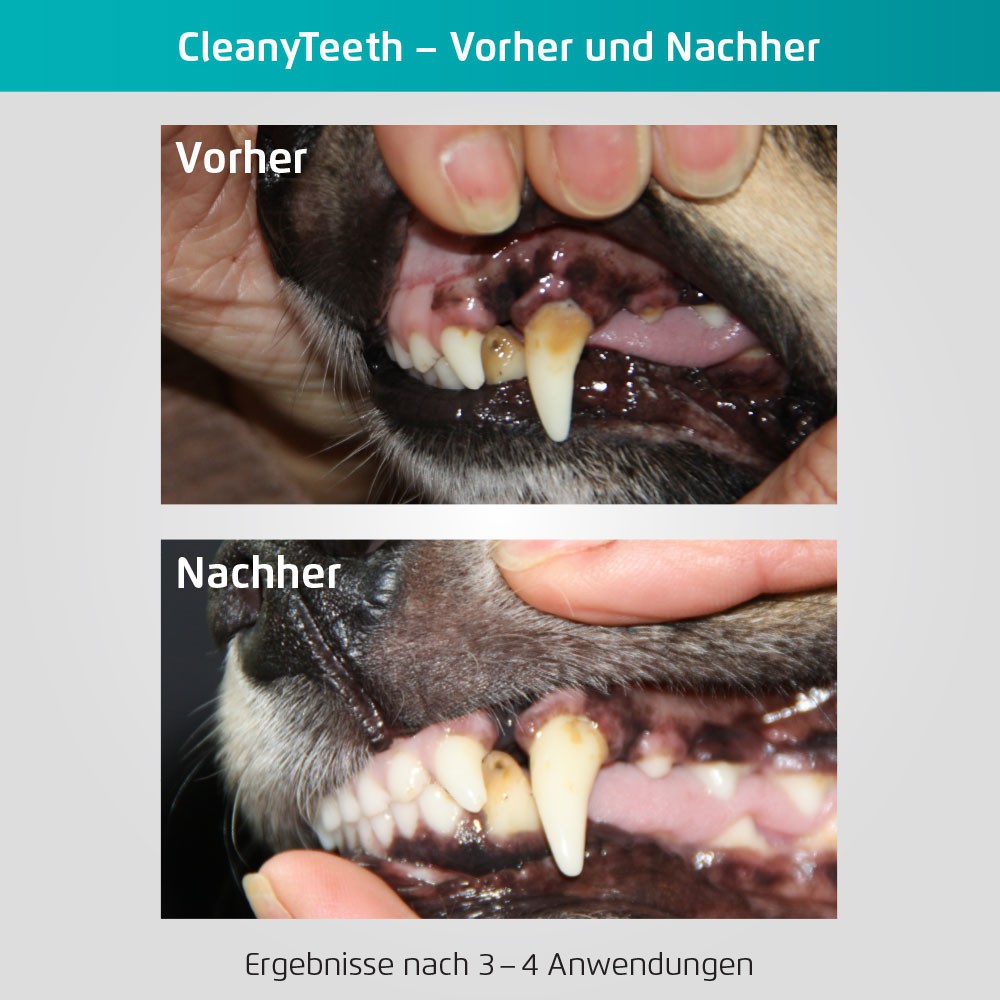 \"cleanyteeth